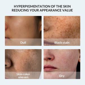 Biosphere Private <b>Label</b> OEM/ODM Moisturizing Skin Care Skincare Natural Organic Whitening Freckle <b>Removing</b> Toner for Face - Product Image 2