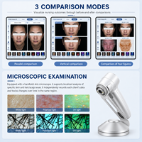 Analyseur de peau AI professionnel, scanner facial pour usage domestique, diagnostic cutané et consultation personnalisée de soins de la peau