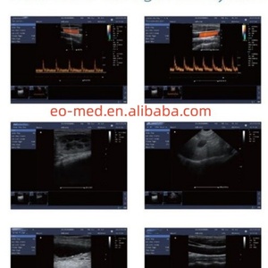 Système d'échographie vétérinaire portable de haute qualité Sonoscape CU23vet avec Doppler couleur - Product Image 6