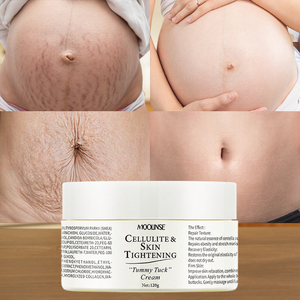 Crème hydratante de réparation de la peau à base de plantes de qualité pour une utilisation corporelle féminine <span class=keywords><strong>efficace</strong></span> dans les vergetures - Product Image 4