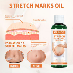 OEM Doğal Bitki Özlü Çatlak İzi Onarıcı Yağ, Hamilelik Cilt Bakımı, Yara İzi Yatıştırıcı ve Nemlendirici Destek 100ml - Product Image 4