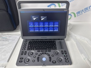 Sonoscape E1V - Escáner de Ultrasonido Veterinario Portátil de Excelente Calidad para Diagnóstico de Embarazo en Caninos/Felines - Product Image 3