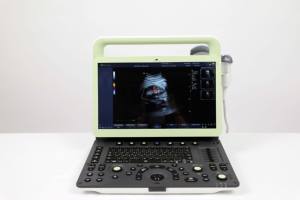 One-Key Automatische Optimalisatietechnologie China Echografie Scaan Hoofd Kleur Doppler Ultrageluid Draagbaar - Product Image 2