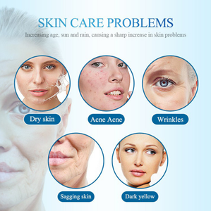 Nouveau jet d'oxygène portable, hydrodermabrasion, soin du visage, élimination des rides, élimination de l'acné, réduction des cernes sous les yeux - Product Image 5