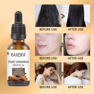 <span class=keywords><strong>Olio</strong></span> <span class=keywords><strong>Essenziale</strong></span> di <span class=keywords><strong>Cannella</strong></span> 100% Puro e Naturale 30ml per Massaggi, Cura del Corpo, Anti-Invecchiamento e Idratazione - Product Image 3