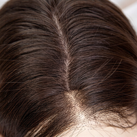 Perruque médicale en cheveux humains vierges européens, base en soie, entièrement en dentelle, sans colle, pré-épilée, pour l'alopécie et le cancer, HD transparente, densité 150%