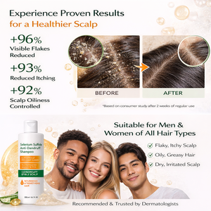 Shampoo antifongique antipelliculaire pour cuir chevelu sec et irrité, traitement du cuir chevelu pour pellicules légères à sévères, soulagement des pellicules - Product Image 4