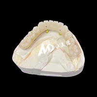 Prothèse dentaire implantée avec piliers en titane et couronne en zircone, fabrication sur mesure CAD/CAM pour cliniques et laboratoires dentaires