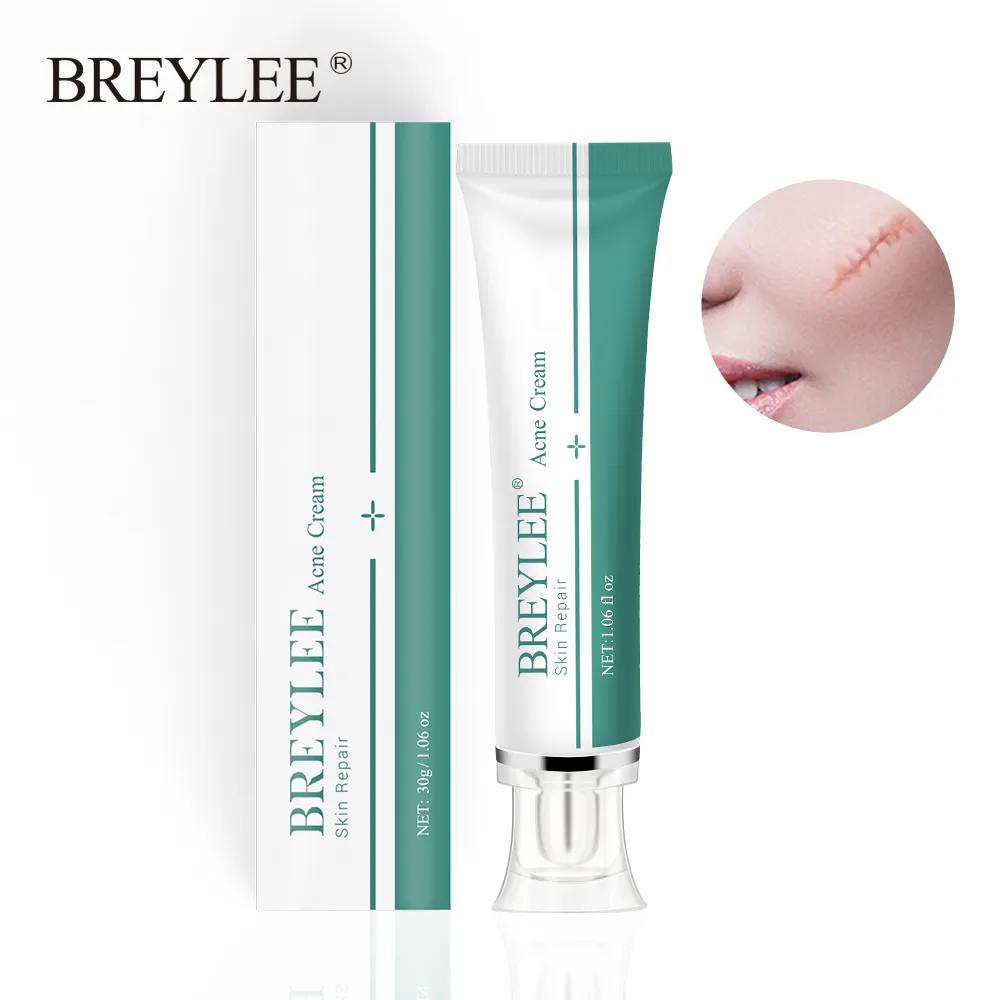 BREYLEE Adult Acne Scar Removal Stretch Mark Remover Cream TCM Organic Herbal Ingredients Whitening Skin Treatment Home Use Box