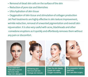 Jet d'oxygène <span class=keywords><strong>oxyjet</strong></span> jetpeel jet peel water peel machine faciale - Product Image 6