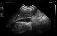 Sistema de Ultrasonido Diagnóstico Digital Completo de Alto Rendimiento en Blanco y Negro, Máquina de Ultrasonido Veterinario Doppler Portátil