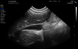 Sistema Ecografico Diagnostico Digitale ad Alte Prestazioni in Bianco e Nero, Ecografo Veterinario Portatile con Doppler - Product Image 4