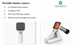 Dispositivo de retinografía de mano, cámara de fondo de retina de mano, portátil, 2 uds. - Product Image 3