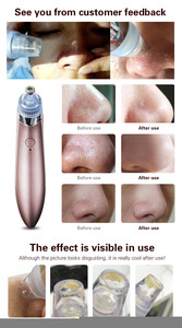 Salon Beauty Electric Nose Pore Suction Skin Care Acne Treatment Spot <b>Cleaner</b> Blackhead Remover Vacuum <b>Extractor</b> Machine - Product Image 5