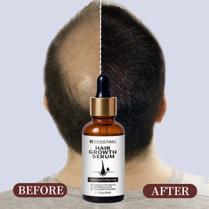 Productos para el Cuidado del Cabello de Alta Calidad con Ingredientes Vegetales, Aceite de Argán que Activa los Folículos Pilosos, Suero Natural que Promueve el Crecimiento del Cabello - Product Image 2