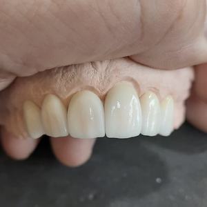 PFZ BAOT impiallacciature per denti naturali protesi Dental Lab investimento materiale dentale in ceramica trasparente T-2 50g - Product Image 4