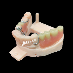 Protesi rimovibili personalizzate con struttura in metallo ripristinare la salute orale, facile da pulire, proteggere la pulizia orale - Product Image 1