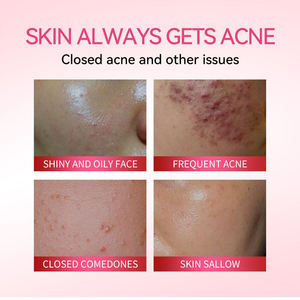 Sérum anti-acné à l'acide salicylique 30 ml, sérum exfoliant anti-imperfections et régulateur de sébum pour peaux grasses, marque privée - Product Image 3