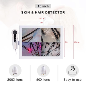 Nuovo Scanner HD per Test dei Follicoli Capillari con Funzione di <span class=keywords><strong>Confronto</strong></span> Prima-Dopo e Lente d'Ingrandimento per Analisi del Viso in Saloni di Bellezza, Wi-Fi - Product Image 3
