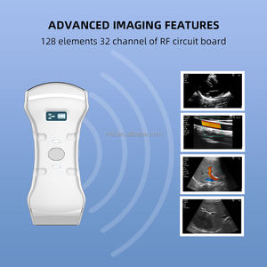 <span class=keywords><strong>3</strong></span>'ü <span class=keywords><strong>1</strong></span> arada konveks/lineer/kardiyak dönüştürücü ve 10hrs pil ile taşınabilir gerçek zamanlı renkli Doppler kablosuz ultrason probu - Product Image 3