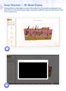 Analizador de Cabello Todo en Uno, Analizador de Cuero Cabelludo Inalámbrico Portátil con Tecnología de IA, Material de Metal ABS, Dispositivo de Cuidado Capilar Ecológico y Seguro - Product Image 4