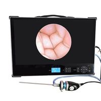 Cámara Endoscópica Portátil de Último Diseño de 24 Pulgadas Full HD 1080P para Veterinaria/Urología/Laparoscopia/Histeroscopia/Equipo