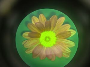 Colposcopio Binocular Kernel KN-2200BII de 6.37 Megapíxeles para la Detección Temprana del Cáncer Cervical y Otras Anomalías Vaginales - Product Image 3