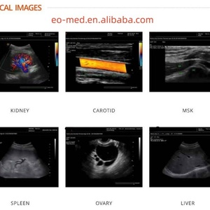 Meilleures ventes : Appareil d'échographie portable pas cher, scanner ultrasonore Doppler couleur CU30 - Product Image 6