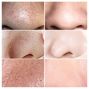 LANBENA हरी चाय नाक ब्लैकहैड हटानेवाला मास्क ताकना सिकुड़ने गहरी साफ नाक स्ट्रिप्स - Product Image 5