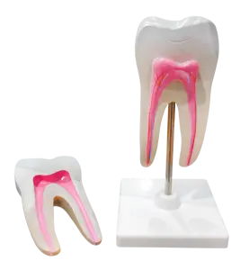 Modello di denti grandi