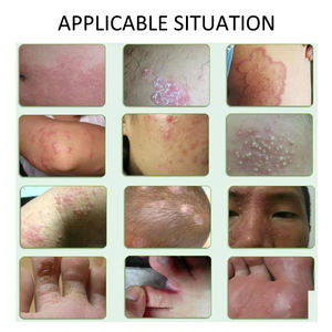 Juego de Ungüentos para el Cuidado de la Piel Qicun <span class=keywords><strong>Basu</strong></span>, Fórmula de Día y Noche, Ingredientes Herbales Naturales para la Salud de la Piel - Product Image 4