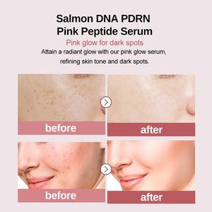 Etiqueta privada Salmón <span class=keywords><strong>Dna</strong></span> Pdrn Pink Peptide Serum Rose Skin Care Serum - Product Image 2