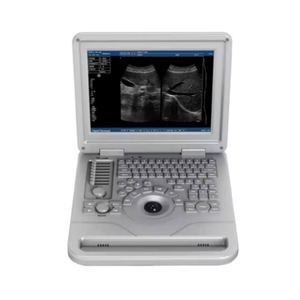 New Design <strong>Laptop</strong> <strong>Ultrasound</strong> Machine Hot Sale Hospital <strong>Ultrasound</strong> Machine Black and White <strong>Color</strong> <strong>Ultrasound</strong> Scanner - Product Image 2