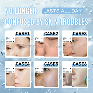 Appareil de soin du visage à jet d'oxygène 14-en-1, hydrodermabrasion, microdermabrasion, équipement de nettoyage en profondeur - Product Image 5