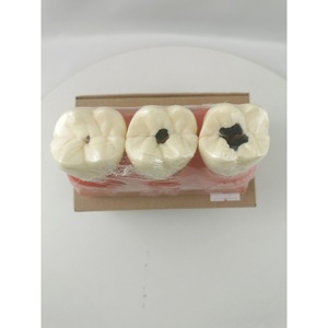 Modelo de dientes M4020 para práctica de caries, herramienta de entrenamiento dental con dientes desmontables - Product Image 2