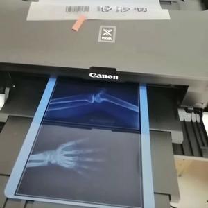 Blue Inkjet Medical Trocken film <span class=keywords><strong>PET</strong></span> Glossy Water proof Rigid für Epson für OKI Fuji Xerox X Ray CT CR DR 210 Mikron - Product Image 2