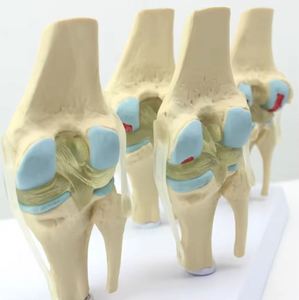 Modelo de articulación de rodilla humana de 4 etapas con tarjeta posterior, recurso didáctico de esqueleto de rodilla, modelo de articulación de rodilla con patología. - Product Image 5