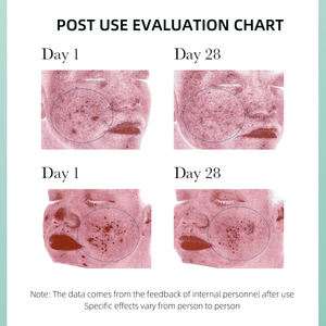 Tea Tree Skin Care <span class=keywords><strong>Kit</strong></span> 4 Productos con control <span class=keywords><strong>de</strong></span> aceite <span class=keywords><strong>de</strong></span> ácido salicílico Anti Acné <span class=keywords><strong>Facial</strong></span> Set para <span class=keywords><strong>piel</strong></span> <span class=keywords><strong>grasa</strong></span> - Product Image 6