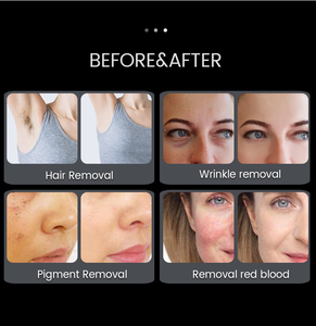 Mesin Kecantikan <span class=keywords><strong>IPL</strong></span> E-<span class=keywords><strong>light</strong></span> Huamei Portabel untuk Peremajaan Kulit dan Penghilang Bulu Laser <span class=keywords><strong>IPL</strong></span> Opt <span class=keywords><strong>IPL</strong></span> - Product Image 6