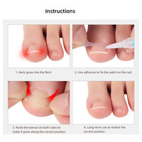 Autocollant de colle à ongles bandes correctrices orthèse de traitement des ongles Patch autocollant correcteur outils de pédicure outils de Correction des ongles d'orteils outil de pied
