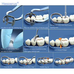 เมทริกซ์โลหะทางทันตกรรมคุณภาพสูง SS316 จำนวน 100 ชิ้น เมทริกซ์โลหะแบบแบ่งส่วนโค้งมน หมายเลข 1.398 - Product Image 6