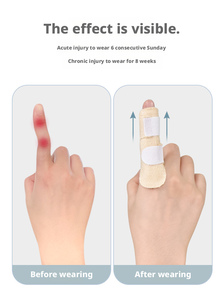 Attelle de fixation réglable pour doigts et pouce, support de protection pour quatre doigts, équipement de gros - Product Image 6