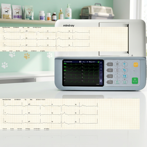 Appareil ECG Mindray BeneHeart R3, électrocardiographe 6 canaux, appareil ECG portable, acquisition ECG 12 dérivations, moniteur ECG hospitalier - Product Image 2