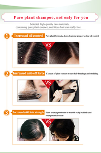 Etiqueta Privada de coco/<span class=keywords><strong>huevo</strong></span>/ajo/<span class=keywords><strong>Oliva</strong></span> <span class=keywords><strong>pelo</strong></span> champú esencia champú - Product Image 5