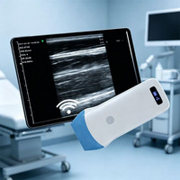 Échographe portable pour hôpital, machine à ultrasons noir et blanc avec sonde linéaire sans fil