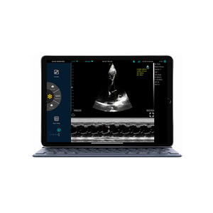 Sonde sans fil à ultrasons de haute qualité multifonctionnel sans fil <span class=keywords><strong>Mini</strong></span> détection d'ultrasons Doppler couleur pour l'abdomen/vasculaire - Product Image 3