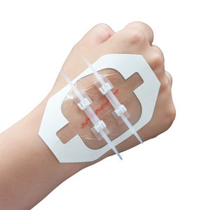 Alat Penutup Luka Kulit Perekat Jahitan Darurat Perlindungan Luka Dapat Dipotong Higienis Zip Stitch Sekali Pakai Bersertifikat CE - Product Image 3