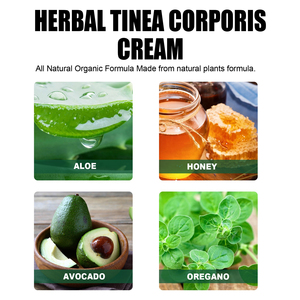 Crema de Fórmula Herbal Antipruriginosa y Antiséptica para Tinea Corporis, Crema Herbal para Uso Externo - Product Image 2