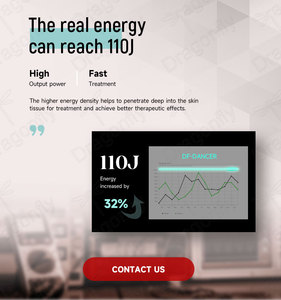 Tẩy lông bằng laser alexandrite Công suất cao | công nghệ xung dài để làm rụng lông hiệu quả | Phích cắm EU phổ quát cấp thương mại - Product Image 6