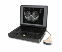 Système d'échographie vétérinaire numérique portable JINZHONG JZ-SW3000, imagerie haute résolution, design ergonomique